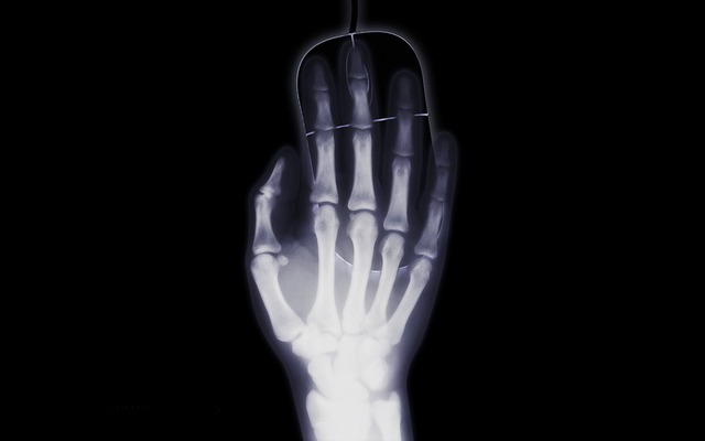 rentgenový obraz
